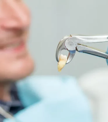 Wisdom Tooth Removal_11zon
